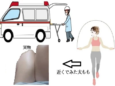 救急車のすぐ近くで縄跳びしてる人